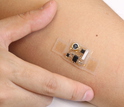 Epidermal electronics on a human arm